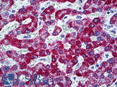 Anti-CPS1 Antibody (clone 8H8) IHC-plus LS-B5392