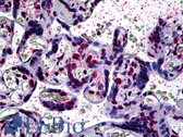 Anti-ARID3A / DRIL1 Antibody (clone 1A11) IHC-plus LS-B5399