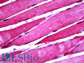 Anti-ENO3 / Enolase 3 Antibody (clone 5D1) IHC-plus LS-B5402