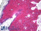 Anti-FGF Receptor / FGFR2 Antibody (clone 1G3) IHC-plus LS-B5408