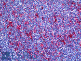 Anti-GSN / Gelsolin Antibody (clone 3G5) IHC-plus LS-B5419