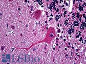 Anti-HTT / Huntingtin Antibody (clone 3F1) IHC-plus LS-B5420