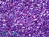 Anti-MKNK1 / MNK1 Antibody (clone 2F12) IHC-plus LS-B5436