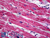 Anti-SPRY1 / Sprouty 1 Antibody (clone 3H4) IHC-plus LS-B5441