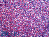 Anti-MARCKS Antibody (clone 2C2) IHC-plus LS-B5450