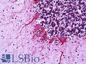 Anti-KRT23 / Keratin 23 Antibody (clone 2B4-3B5) IHC-plus LS-B5456