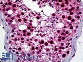 Anti-NEK2 Antibody (clone 2F6) IHC-plus LS-B5478