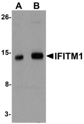 Anti-CD225 / IFITM1 Antibody (Internal) IHC-plus LS-B5485