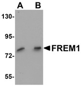 Anti-FREM1 Antibody (C-Terminus) IHC-plus LS-B5486