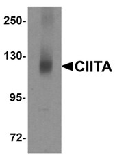 Anti-CIITA Antibody (N-Terminus) IHC-plus LS-B5490