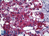 Anti-PIM1 / Pim-1 Antibody (clone 3F5) IHC-plus LS-B5498