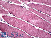 Anti-PIM1 / Pim-1 Antibody (clone 6A2) IHC-plus LS-B5499