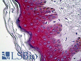 Anti-JUP/CTNNG/Junction Plakoglobin Antibody (C-Terminus) IHC-plus LS-B5502