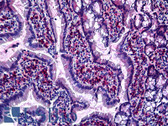 Anti-GJB2 / CX26 / Connexin 26 Antibody (Cytoplasmic Domain, clone CX-12H10) IHC-plus LS-B5511
