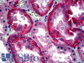 Anti-Basigin / Emmprin / CD147 Antibody (clone UM-8D6) IHC-plus LS-B5513