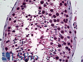 Anti-PREX1 / P-REX1 Antibody (Internal) IHC-plus LS-B5514