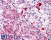 Anti-KIAA0152 / MLEC Antibody (Internal) IHC-plus LS-A8206