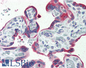 Anti-ERP44 Antibody (C-Terminus) IHC-plus LS-A8259