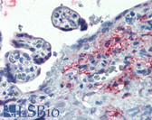 Anti-ERP44 Antibody (Internal) IHC-plus LS-A8263