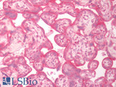 Anti-SLC5A6 / SMVT Antibody (Internal) IHC-plus LS-A8757