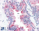 Anti-ADAM20 Antibody (Internal) IHC-plus LS-A8802