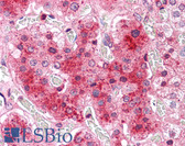 Anti-COMT Antibody (N-Terminus) IHC-plus LS-A8831