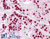 Anti-COMT Antibody (Internal) IHC-plus LS-A8833