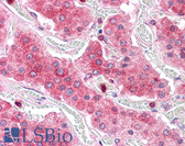 Anti-COMT Antibody (Internal) IHC-plus LS-A8834