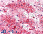 Anti-COMT Antibody (C-Terminus) IHC-plus LS-A8836