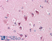 Anti-SLC29A1 / ENT1 Antibody (C-Terminus) IHC-plus LS-A8926