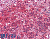 Anti-C4.4A / LYPD3 Antibody (N-Terminus) IHC-plus LS-A8939