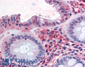 Anti-SLC1A5 / ASCT2 Antibody (Internal) IHC-plus LS-A9042
