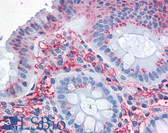 Anti-SLC1A5 / ASCT2 Antibody (Internal) IHC-plus LS-A9043