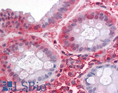 Anti-SLC1A5 / ASCT2 Antibody (Internal) IHC-plus LS-A9044