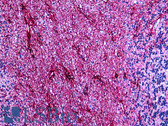 Anti-GFAP Antibody (clone GFA-02) IHC-plus LS-B5556
