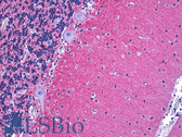 Anti-NCAM / CD56 Antibody (clone 123C3) IHC-plus LS-B5569