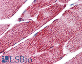 Anti-HSPA9 / Mortalin / GRP75 Antibody (C-Terminus) IHC-plus LS-B5579