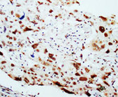 HSP40 IHC Antibody