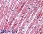 Anti-PDK2 Antibody (aa251-300) IHC-plus LS-B5583