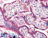Anti-RYBP Antibody (aa71-120) IHC-plus LS-B5584