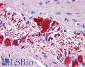 Anti-SSBP2 Antibody (aa131-180) IHC-plus LS-B5585