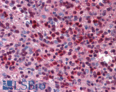 Anti-SIRT6 / Sirtuin 6 Antibody (C-Terminus) IHC-plus LS-B5588