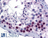 Anti-SIRT6 / Sirtuin 6 Antibody (aa56-105) IHC-plus LS-B5589