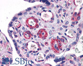 Anti-SUZ12 Antibody (aa362-411) IHC-plus LS-B5591