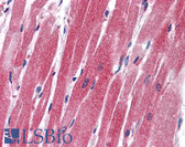Anti-SNAI2 / SLUG Antibody (aa92-141) IHC-plus LS-B5598