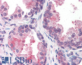 Anti-BAF60B / SMARCD2 Antibody (aa431-480) IHC-plus LS-B5599