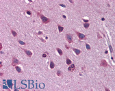 Anti-ZEB2 Antibody (aa30-79) IHC-plus LS-B5600