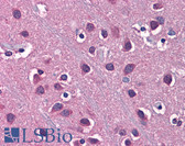 Anti-SLC1A2 / EAAT2 / GLT-1 Antibody (aa144-193) IHC-plus LS-B5601