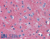 Anti-SLC1A2 / EAAT2 / GLT-1 Antibody (aa467-516) IHC-plus LS-B5602
