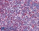 Anti-CHD4 Antibody (aa71-120) IHC-plus LS-B5605
